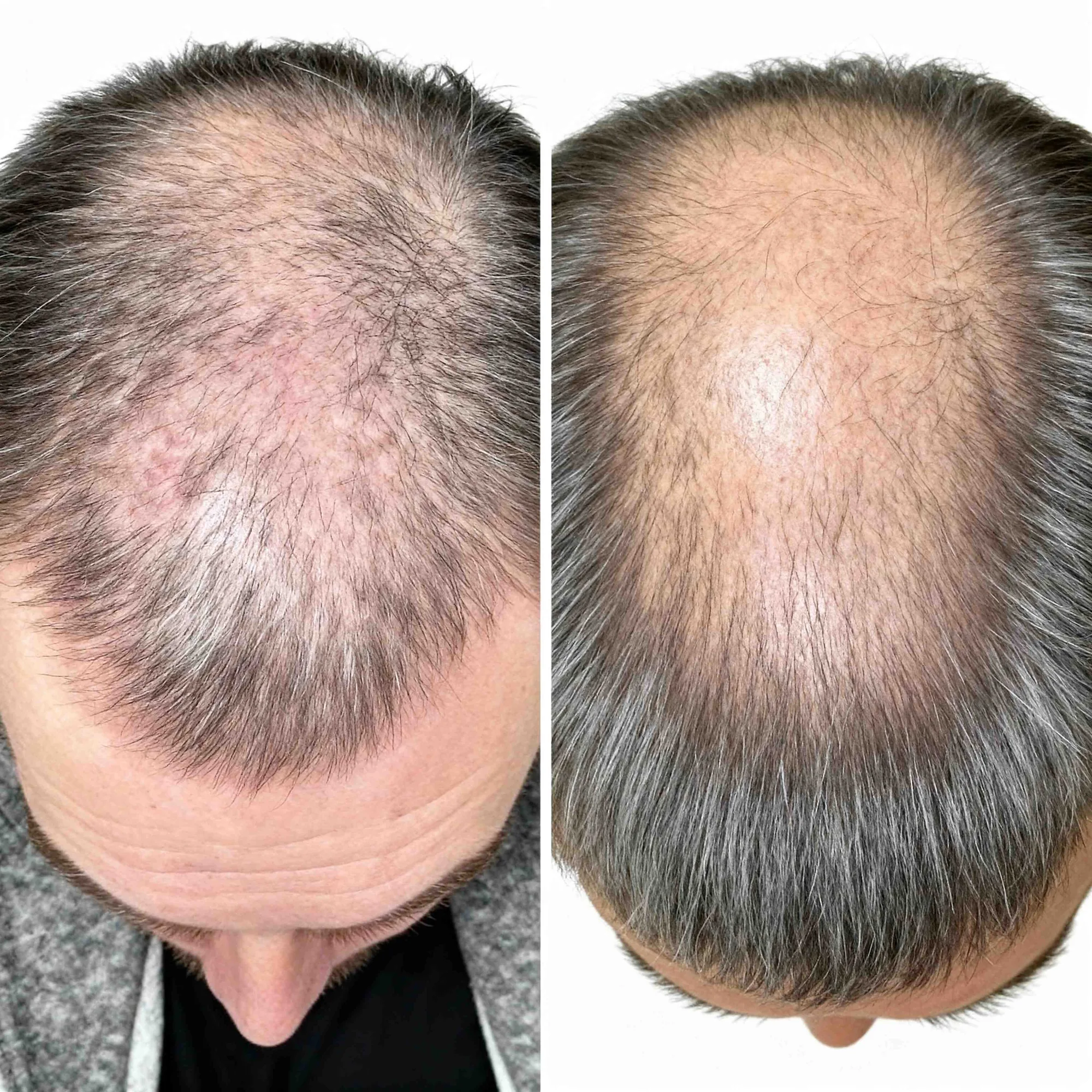 Hair transformation result 10