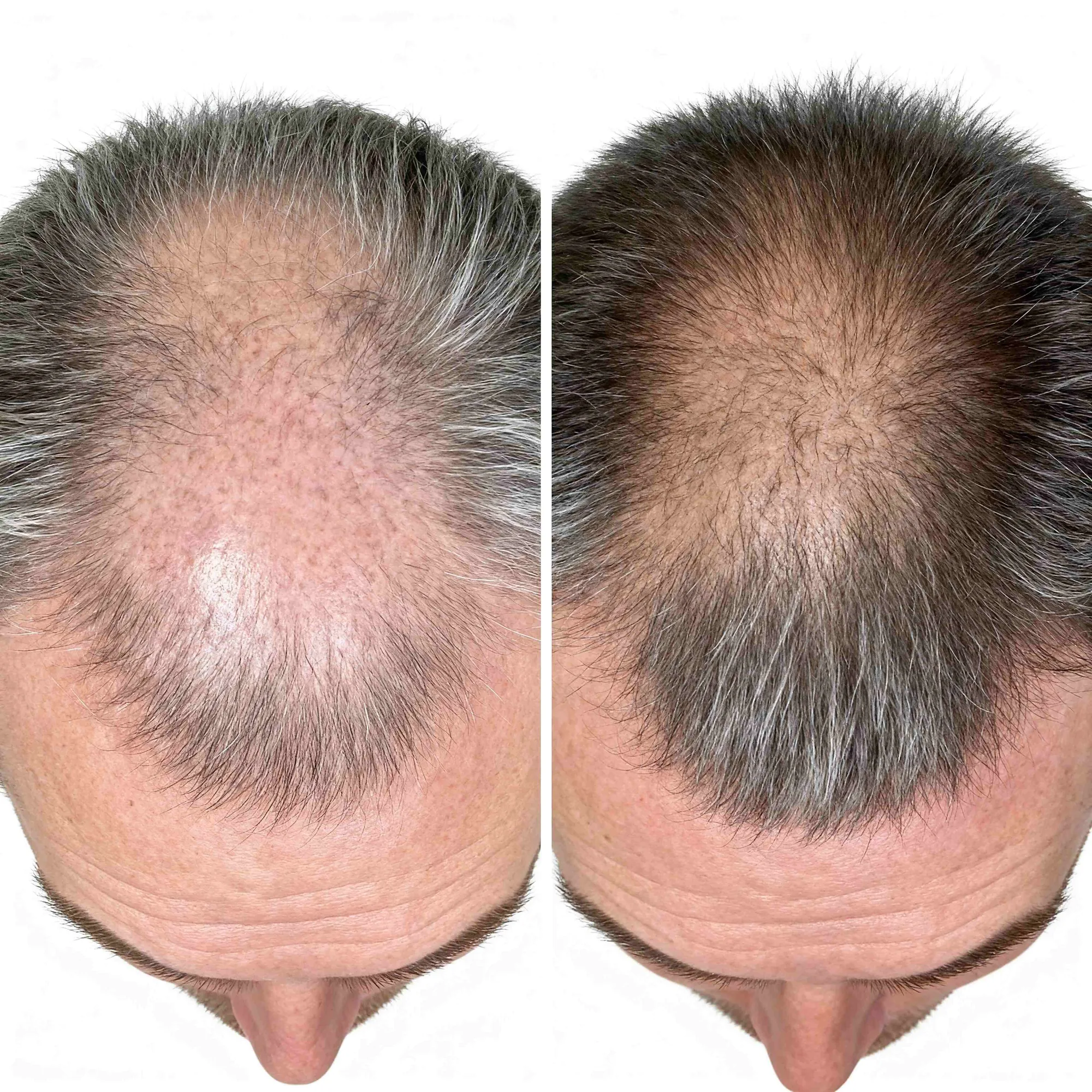 Hair transformation result 2