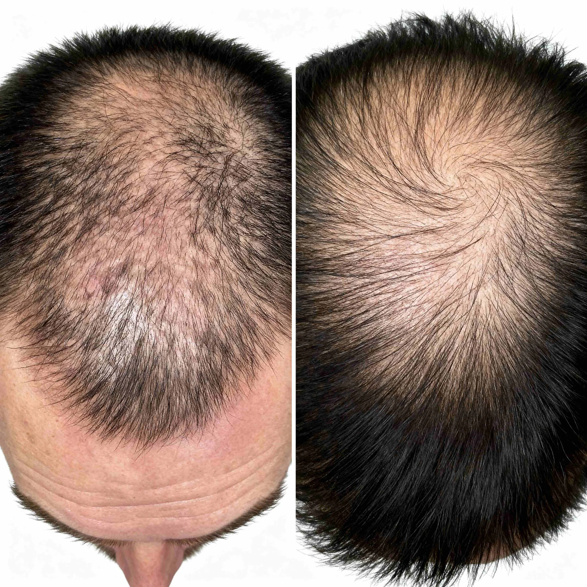 Hair transformation result 4