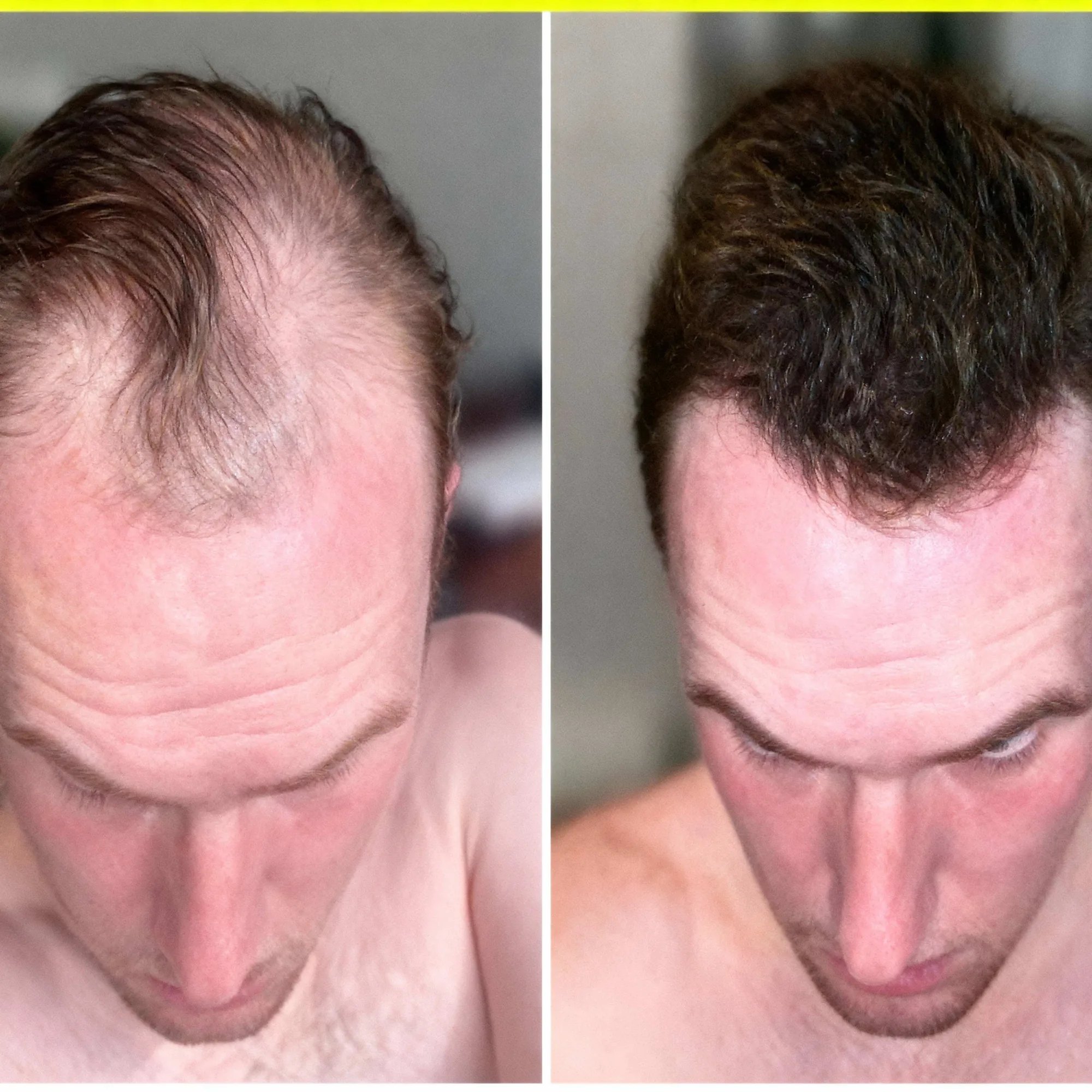 Hair transformation result 5