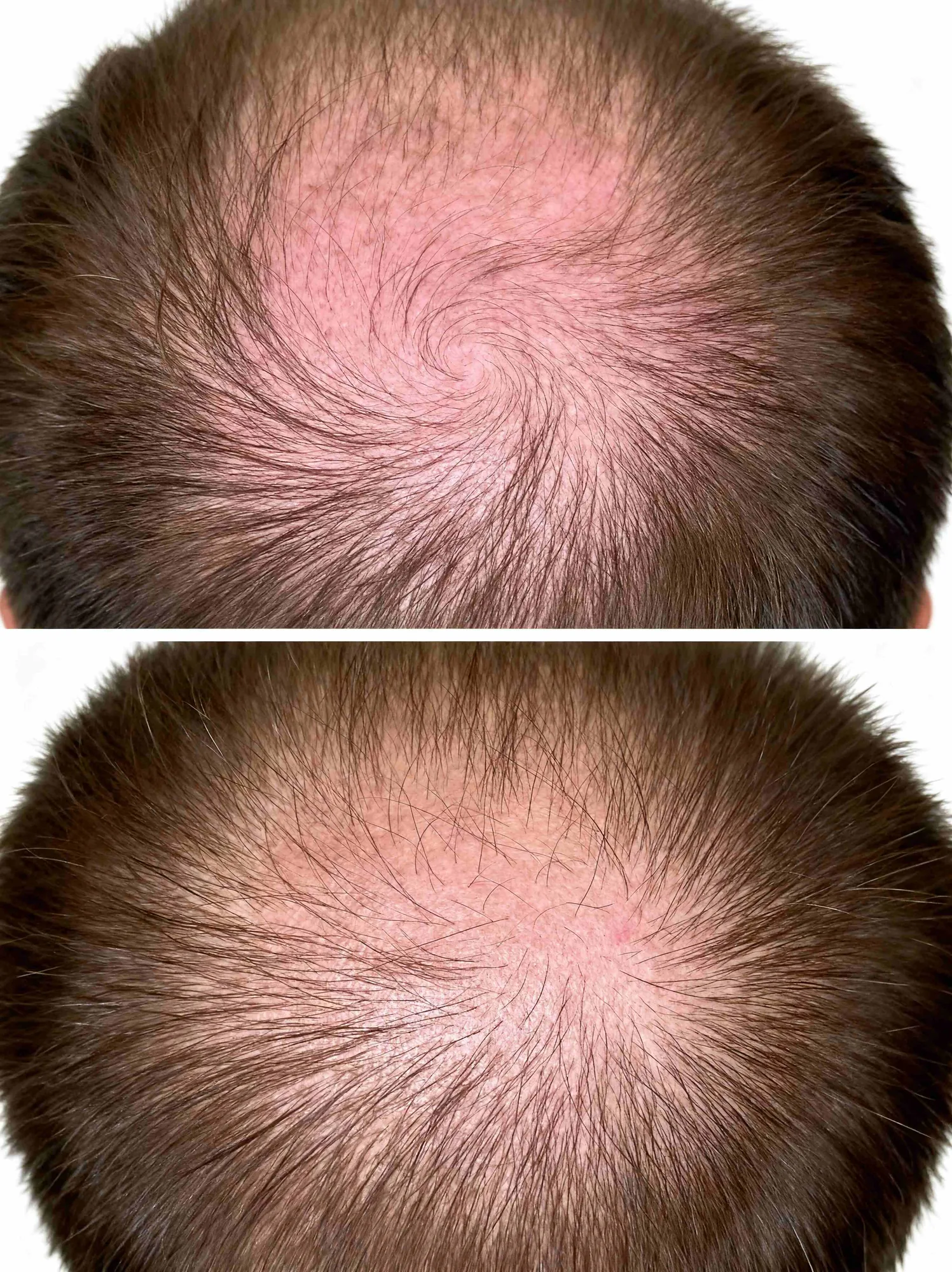 Hair transformation result 6