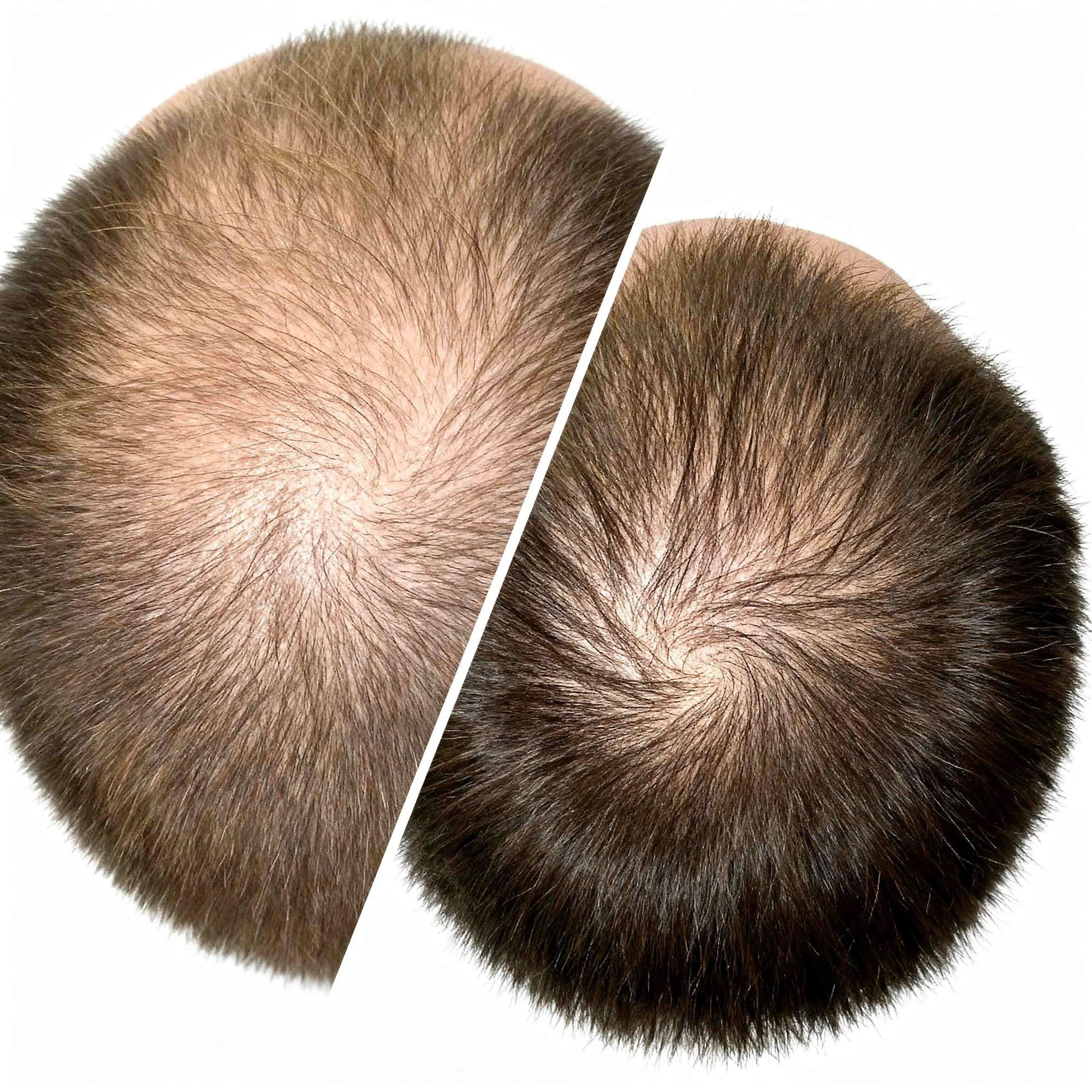 Hair transformation result 7